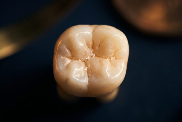 Sillons d'une molaire en très gros plan, avec quelques cristaux de sucre