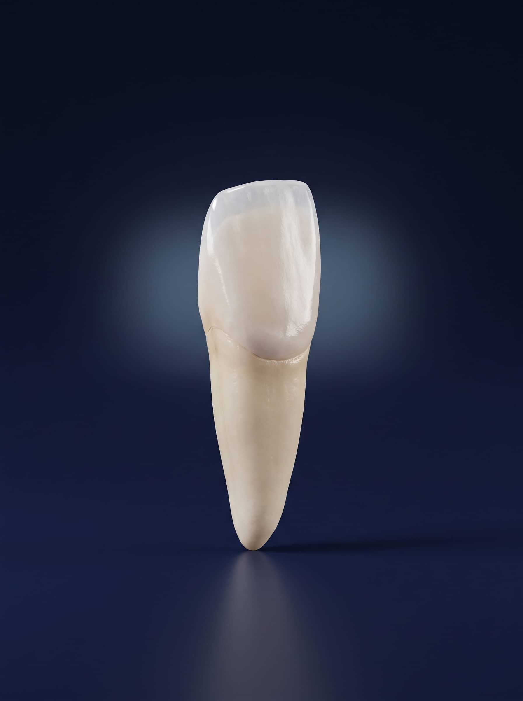 Image de synthèse d'une incisive avec une facette céramique ultra fine collée sur sa face visible